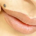 I nei sono pericolosi? Quando preoccuparsi